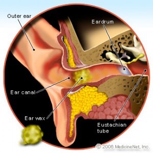 Ear Wax